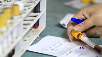 صورة وزارة الداخلية توجه بتشكيل لجنة لإجراء الفحص الطبي لمنتسبيها بشأن المخدرات