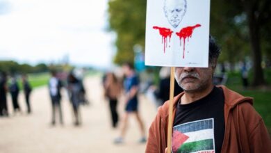 صورة أطباء غزة يجرون عمليات جراحية على الأرض ودون تخدير