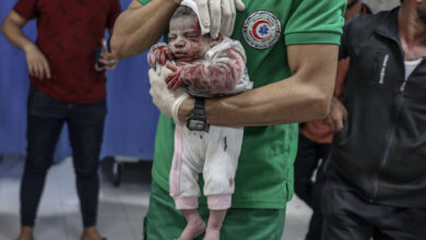 صورة أطفال غزة بلا طعام ويشربون مياهًا ملوثة