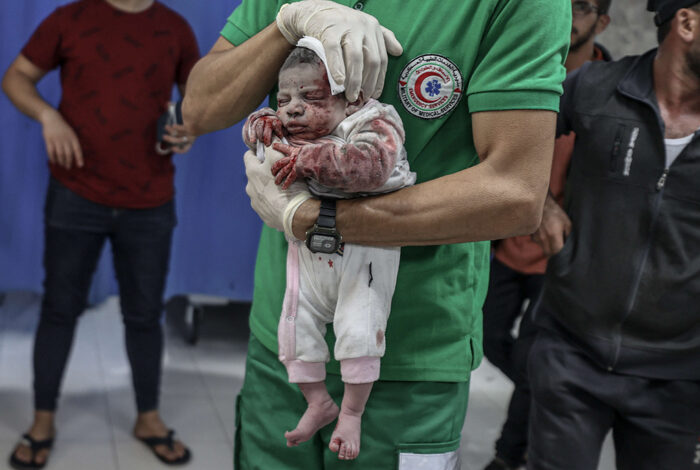 صورة أطفال غزة بلا طعام ويشربون مياهًا ملوثة