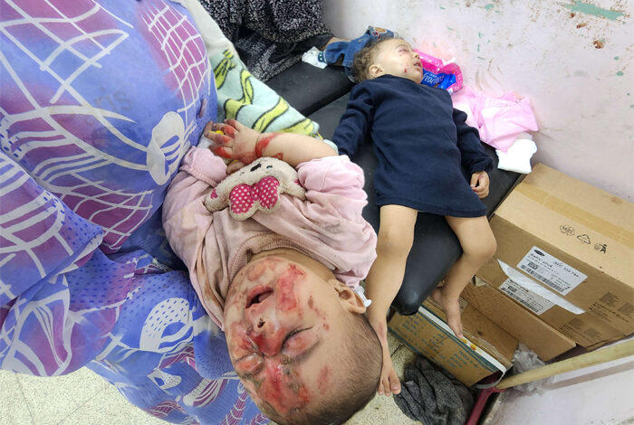 صورة حرب الإبادة اللاأخلاقية تصل إلى الأطفال الخدج في مستشفيات غزة