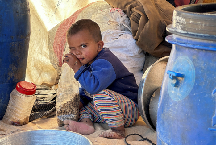 صورة مجموعة التغذية العالمية: طفل من كل 6 أطفال بشمال غزة يعاني سوء التغذية الحاد