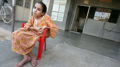 صورة جيل من الولادة المشوهة في العراق بعد احتلاله