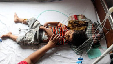 صورة مرض الحصبة يهدد أطفال العراق