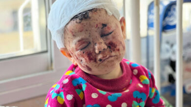 صورة وحشية العدوان تقتل 4 أطفال كل ساعة في غزة