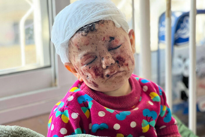 صورة وحشية العدوان تقتل 4 أطفال كل ساعة في غزة