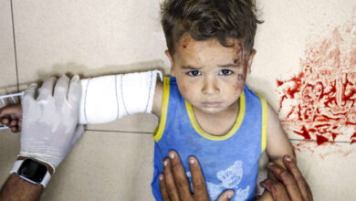 صورة الأمم المتحدة واليونيسف تحذران من التأثير الكارثي والوضع المزري الذي يواجهه أطفال غزة