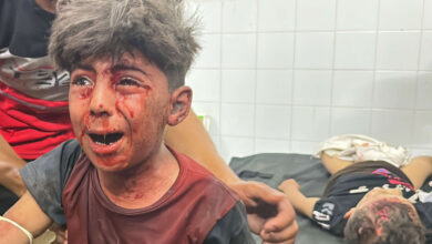 صورة مجمع ناصر الطبي: بتنا نركز على إنقاذ الأطفال والنساء دفاعا عن العِرق الفلسطيني