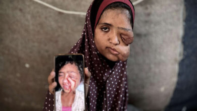 صورة مأساة فتاة فلسطينية تجسد وحشية العدوان على المدنيين والمرضى في غزة