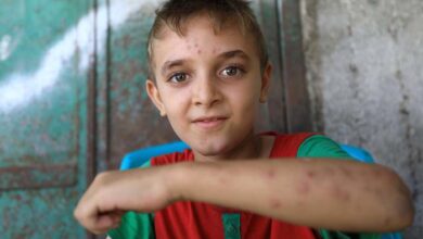 صورة الصحة العالمية تحذر من تفشي شلل الأطفال في غزة
