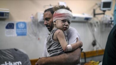 صورة طبيب أمريكي عائد من غزة: الجيش الـ”إسرائيلي” يتعمد قتل الأطفال بأسلحة غير اعتيادية