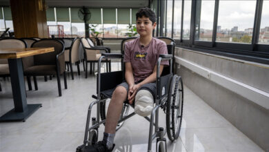 صورة الحرب والصدمة وشح البدائل، ثالوث يقتل الأمل لدى مبتوري الأطراف في غزة