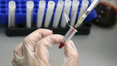 صورة صحة أربيل تسجل 40 إصابة جديد بفيروس “الإيدز” منذ مطلع العام الجاري
